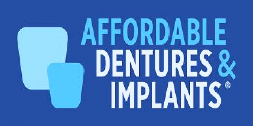 Jobs with Affordable Dentures & Implants | JobsHQ